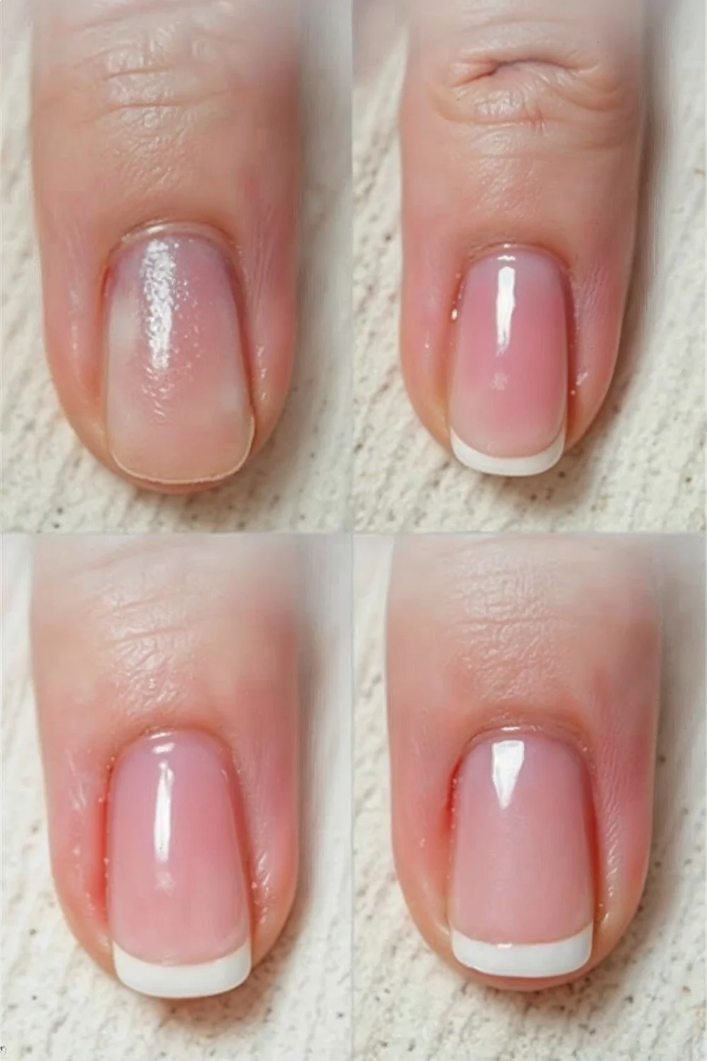 Timeline progression of nail recovery stages from damaged to healthy natural nails with coral pink french tips